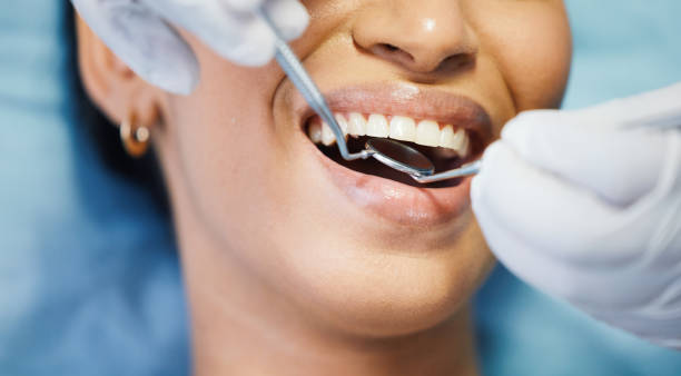 Best Emergency Tooth Extraction in Coeur Dalene, ID